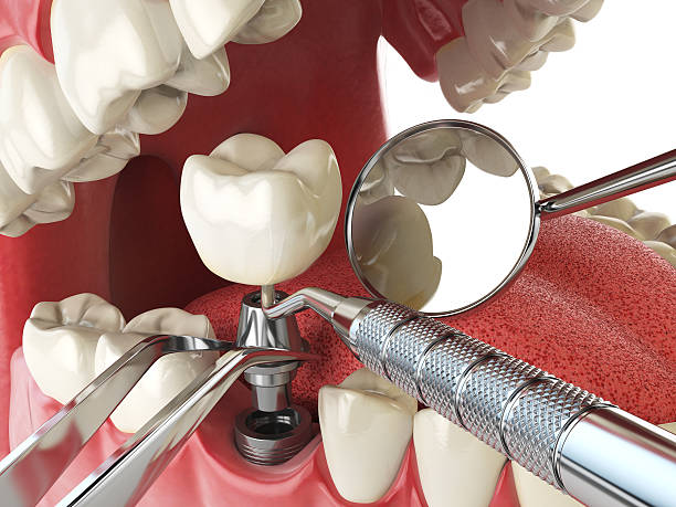 Best Tooth Infection Emergency Dentist  in Pine Level, NC